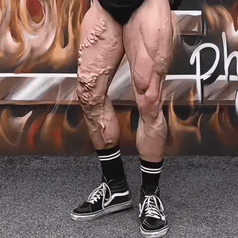 Vee Vesom Lymphatic Damage & Sliming Patches (10 Patches)