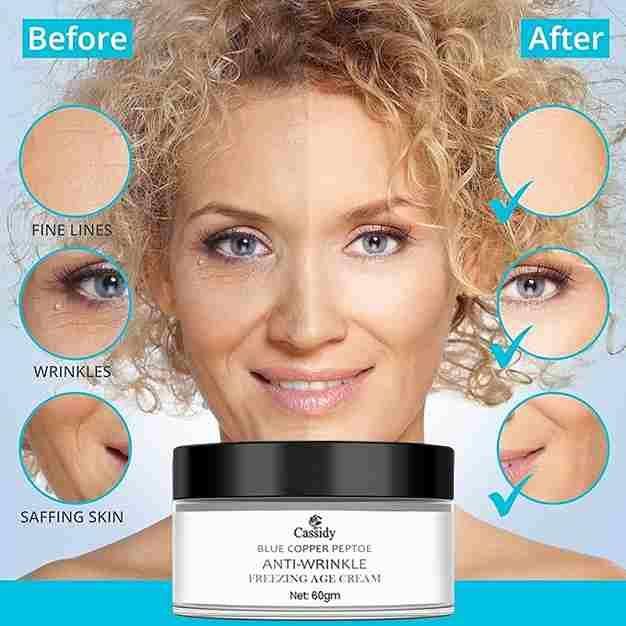 Anti-Wrinkle Face Cream